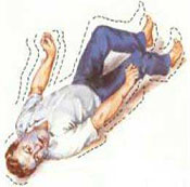 西安的癫痫病要做哪些检查 西安的癫痫病要做哪些检查